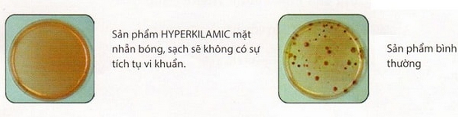 cong-nghe-hyperkilamic-1 cong nghe hyperkilamic 1