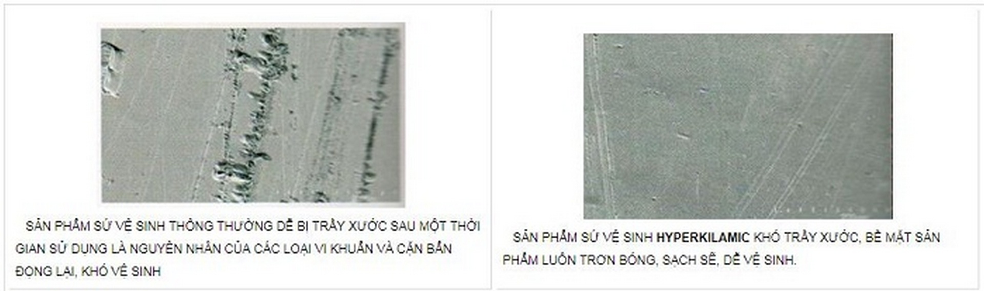 cong-nghe-hyperkilamic-2_1 cong nghe hyperkilamic 2 1