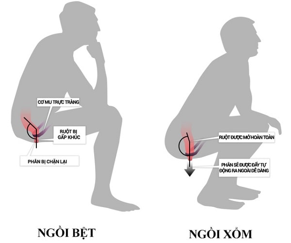 ngoi-bon-cau-bet-va-xom-loai-nao-tot-cho-suc-khoe-1_1 ngoi bon cau bet va xom loai nao tot cho suc khoe 1